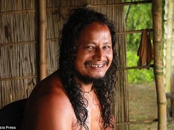 Kisah Barman, 40 Tahun Tak Kenakan Pakaian karena Alergi