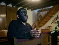 Kisah Aceves, Manusia Berbulu Lebat yang Dipanggil Manusia Serigala