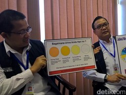 Bagaimana Urine Anda Hari Ini?