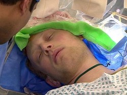 Pertama Kalinya Dokter Bedah Pakai Laser Khusus untuk Temukan Tumor Otak