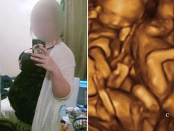 10 Bulan Tak Kunjung Melahirkan, Gadis ini Ternyata Cuma Pura-pura Hamil