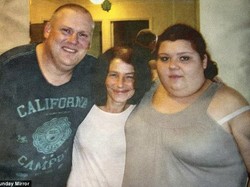 Obesitas dengan Bobot 246 Kg, Wanita Ini Meninggal Dunia di Usia 20 Tahun