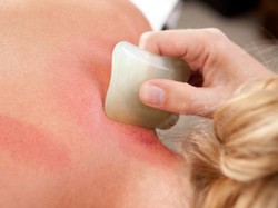 Kerokan untuk Jaga Kondisi Saat Cuaca Ekstrem, Manjurkah?