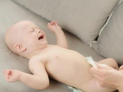 Ada Bercak Merah di Kulit Bayi Akibat Popok Jarang Diganti, Waspada Diaper Rash