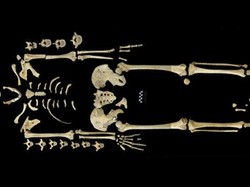 Inikah Pasien Kanker Darah Tertua di Dunia?