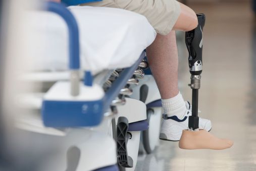 Man wearing prosthetic leg in hospital