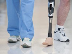 Akibat Diabetes Tak Terkontrol, Pria Ini Harus Kehilangan Kaki