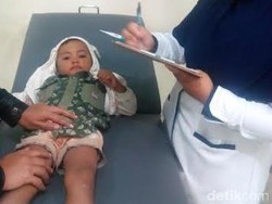 Hii..Hidung Bocah 5 Tahun ini Keluar Lintah