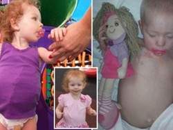 Idap Kanker, Bocah Ini Hidup dengan Tumor Seukuran Bola Sepak di Perut