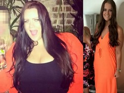 Susah Jalan karena Kegemukan, Simone Diet dan Turunkan Bobot 89 Kg