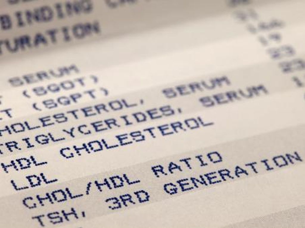 Awas! Kenali Gejala Kolesterol Tinggi, Bisa Jadi Penyakit Serius