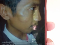 Satgas Partai di Bantul Jadi Tersangka Pemukulan Anggota Panwascam