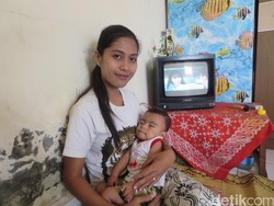 Kisah Rita, Ibu Muda di Bantul yang Merawat Anak dengan Sindrom Langka