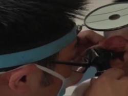 Hii, Dokter di Tiongkok Angkat Keluar Kelabang dari Telinga Wanita Ini