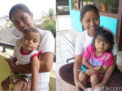 Salut! Begini Orang Tua Anak CdLS Hadapi Tantangan pada Buah Hati Mereka