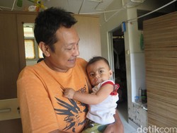 Anak Dipuji karena Alisnya Tebal, Padahal Gejala Sindrom Langka