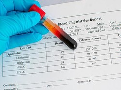 7 Tes Kesehatan yang Sebaiknya Dilakukan di Usia 73 Tahun