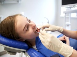 Ingat, Bersihkan Karang Gigi 2 Kali dalam Setahun