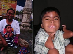 Jadi Aktivis CdLS Indonesia, Begini Harapan Koko Prabu