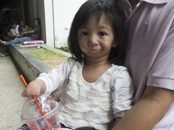 Lahir dengan Mulut Menutup, Bocah Filipina ini Akhirnya Dioperasi