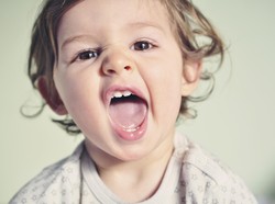 Gigi Geraham Anak Berlubang, Perlukah Dicabut?