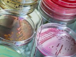 Virus Alien dari Luar Angkasa Bisa Ancam Manusia