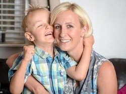 Lahir dengan Sindrom Langka, James Dua Kali Lebih Tinggi dari Sebayanya