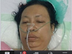 Foto Jemaah Haji Wanita Terbaring Sakit Bukan dari RI, Tapi Burma