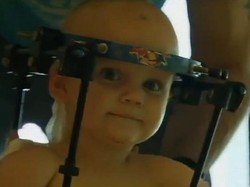 Kepalanya Lepas Saat Kecelakaan, Bocah Ini Selamat di Meja Operasi