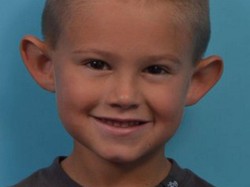 Gerah Di-bully Karena Kuping Mirip Peri, Bocah Ini Akhirnya Dioperasi