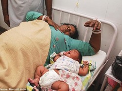 Ini Dia Bayi Terbesar di India, Bobotnya 5,8 Kg Saat Lahir