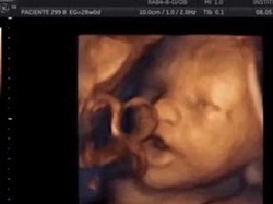 Seperti Bernyanyi, Begini Cara Janin Merespons Suara dari Luar