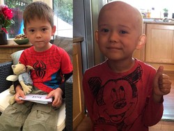 Pipi Nyeri Dikira Sariawan, Joshua Ternyata Kena Kanker