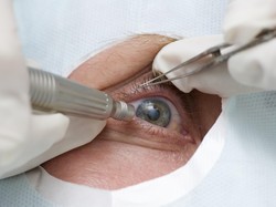 Kecelakaan Saat Tur Bikin Mata Lauren Juling Atas-bawah