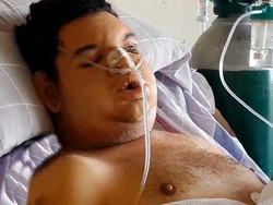 Digigit Laba-laba Paling Mematikan, Orlando Sampai Gagal Ginjal