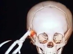 Geger! Warga Garut Temukan Tengkorak dalam Karung