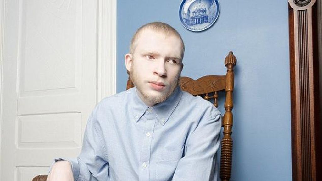 Potret Albino yang Juga Bisa Cantik dengan Cara Mereka Sendiri