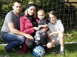 Idap Urtikaria Kronis, Cuaca Dingin Bisa Bahayakan Nyawa Jen