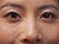 7 Cara Atasi Kantung Mata Menebal Karena Kurang Tidur Saat Puasa