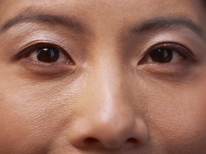 4 Penyebab Kedutan Tak Biasa: Cacing Parasit Hingga Overdosis Kafein 4 Penyebab Kedutan Tak Biasa: Cacing Parasit Hingga Overdosis Kafein