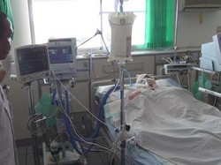 Korban Kebakaran Hutan Gunung Lawu Masih Kritis