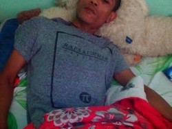 Buruh Rokok ini Cacat Kecelakaan Kerja Tanpa Menerima Haknya