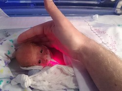 Lahir Prematur, Bayi ini Disimpan Dalam Kotak Sandwich