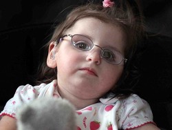 Kena Sindrom Langka, Bocah Ini Diprediksi Takkan Sempat Tumbuh Dewasa