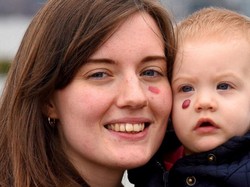 Dukung Putrinya yang Punya Tumor di Pipi, Jessica Coret Pipi dengan Lipstik