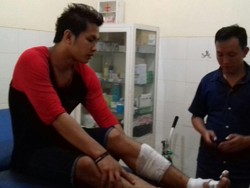 Ledakan Mal Alam Sutera, Karyawan Kantin Luka Bakar di Kaki