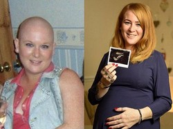 Divonis Usianya Tinggal 6 Bulan, Pengidap Kanker Langka Ini Pantang Menyerah