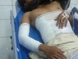 Pria ini Hendak Bakar Rusun Tapi Justru Terbakar Sendiri