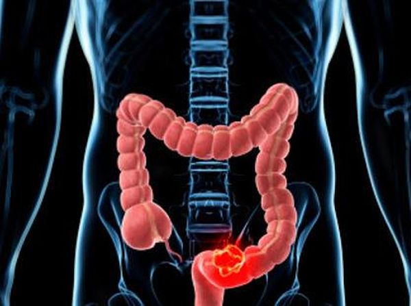 Fakta-fakta Gastroenteritis, Penyakit yang Diidap Balita di Blitar