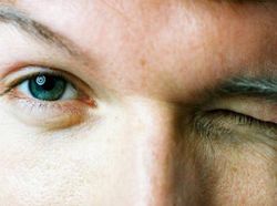 Mengatasi Gangguan Penglihatan Usai Kena Belekan